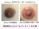 カルミア(kalmia)の写真