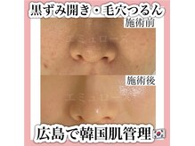 エミュローズ 段原店(Nm' Rose)