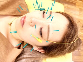 あおなみ はり きゅう整骨院の写真/お顔のツボを刺激！「美容鍼」は血行を促進し《しわ改善/たるみ改善/くすみ改善/クマ/眼精疲労》に効能あり