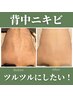 【背中ニキビケア】お背中ツルツル★ハーブピーリング 60分/33000→29800
