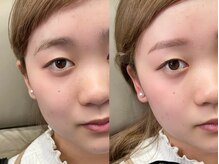 チル アンド アイ 船橋駅前店(Chill&Eye)/美眉スタイリング/BeforeAfter