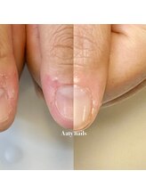 アーティネイルズ(Aaty Nails)/深爪の方に最善のやり方を