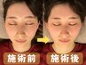 【再来】骨盤矯正＋小顔矯正コース☆40分