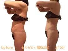 エステティックサロン フェアリー(ESTHETIC SALON FAIRLY)