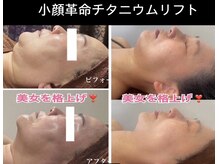 アルページュ(Arpege)