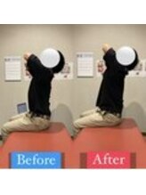 ナオル整体 宮崎院(NAORU整体)/20代男性施術事例【猫背改善】