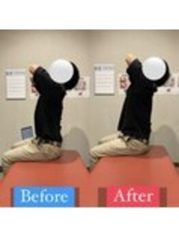 ナオル整体 宮崎院(NAORU整体)/20代男性施術事例【猫背改善】