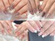 リノネイル(Rino-nail)の写真