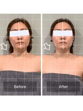 カドル(cuddle)/PARAFUSE.式ドライヘッドスパ