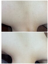 コオリナ(Ko Olina)/手の届かない部分も