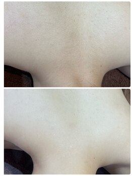 コオリナ(Ko Olina)/手の届かない部分も