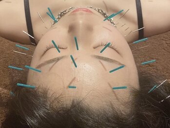 ビビオンリーワン 銀座築地(vivi only one)/美容鍼