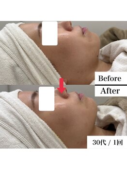 グラシア 宇土店(gracia)/