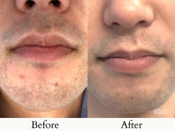 towasmile/ビフォーアフター