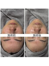 サラン スキンサロン(Sarang skin salon)/