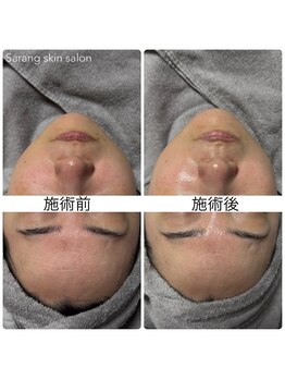 サラン スキンサロン(Sarang skin salon)/