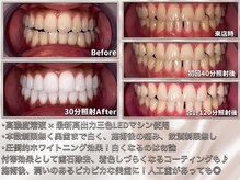 ライトビューティー 関内店(LIGHT BEAUTY)