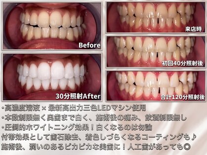 ライトビューティー 関内店(LIGHT BEAUTY)の写真
