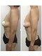 ヴェルナ(VELUNA)の写真/バストだけじゃない。二の腕・お腹・ヒップまで全身ケア♪なりたい自分へ導くVELUNAの本格ボディメイク！