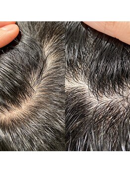 シュール センター南(SURREAL)/ヘッドスパ後のビフォーアフター