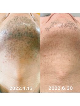 サロン ド ワイシス(Salon de ysis)/