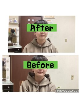 ソラ(SORA)/腰痛施術からの小顔矯正。