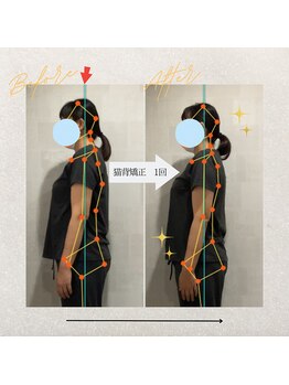 ラクリエ 東加古川院(La Creer)/お客様ビフォーアフター