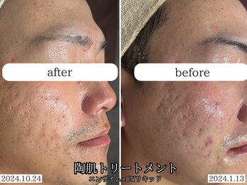サロンベース(salon BASE)/メンズにも人気です(^^)