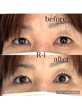 アールアイ(R-i)/アイリッドアップパーマ+BF