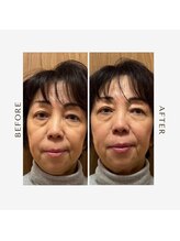 あかり鍼灸接骨院/60代女性　Before/After