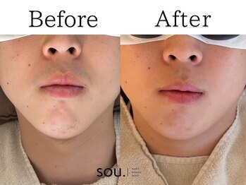 ソウ 越前店(sou.)/