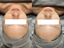 ナーズ(NAZ)/MIRROR ピール