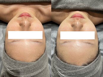 ナーズ(NAZ)/MIRROR ピール