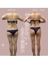 ソワン 小岩店(Soin)/ 20代　アーユルヴェーダ