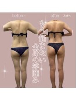 ソワン 小岩店(Soin)/ 20代 アーユルヴェーダ