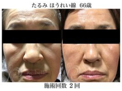 パルファンカルムの写真