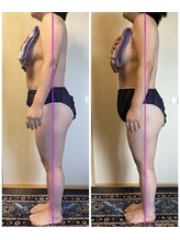 ローズ 下松(ROSE)/【筋膜リリース150分】