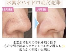 アールファースト(ar first)の雰囲気（毛穴/角栓/小鼻の黒ずみに水素水ハイドロ毛穴洗浄が人気◎）