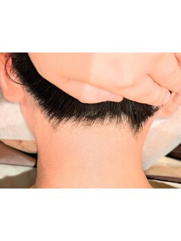 脱毛デビューにオススメのサロン