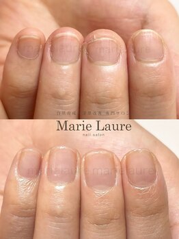 マリーロール 淀屋橋本店(Marie Laure)/自爪育成/深爪矯正/ネイルケア