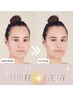 未来の美肌の為の『future＊facial』ピーリング&アクネケアコース