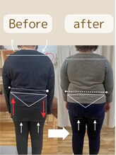 アイヲン(Aiwon)/【むくみ】【だるさ】