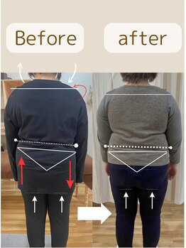 アイヲン(Aiwon)/【むくみ】【だるさ】