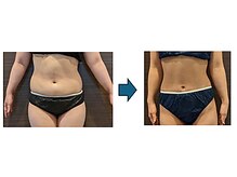 ローブメール(Robemail)/ビフォーアフター