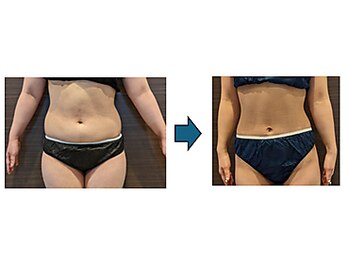 ローブメール(Robemail)/ビフォーアフター