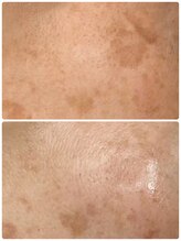 ギャラクシービューティー(galaxy beauty)/プラズマ