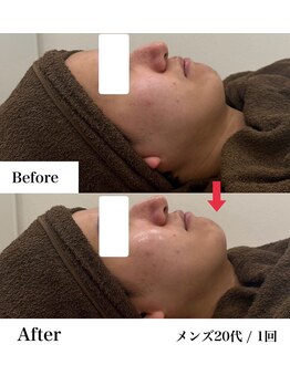 グラシア 宇土店(gracia)/