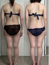 ヨルエステ(yoru aesthe)/