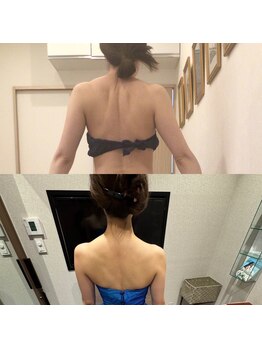 ディア スプリーマ/ブライダル4ヶ月12回の効果☆