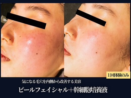 エヴァーグレース 栄店の写真